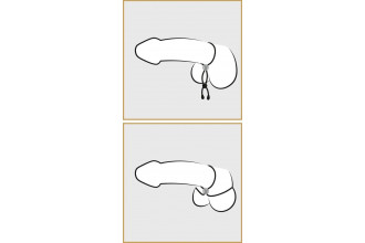 Лассо для пениса Double Cock Loop